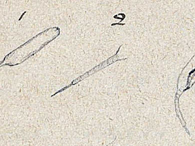 3 sketches by Dr Charles of the worm he found in the water near Robat-e Mirza.